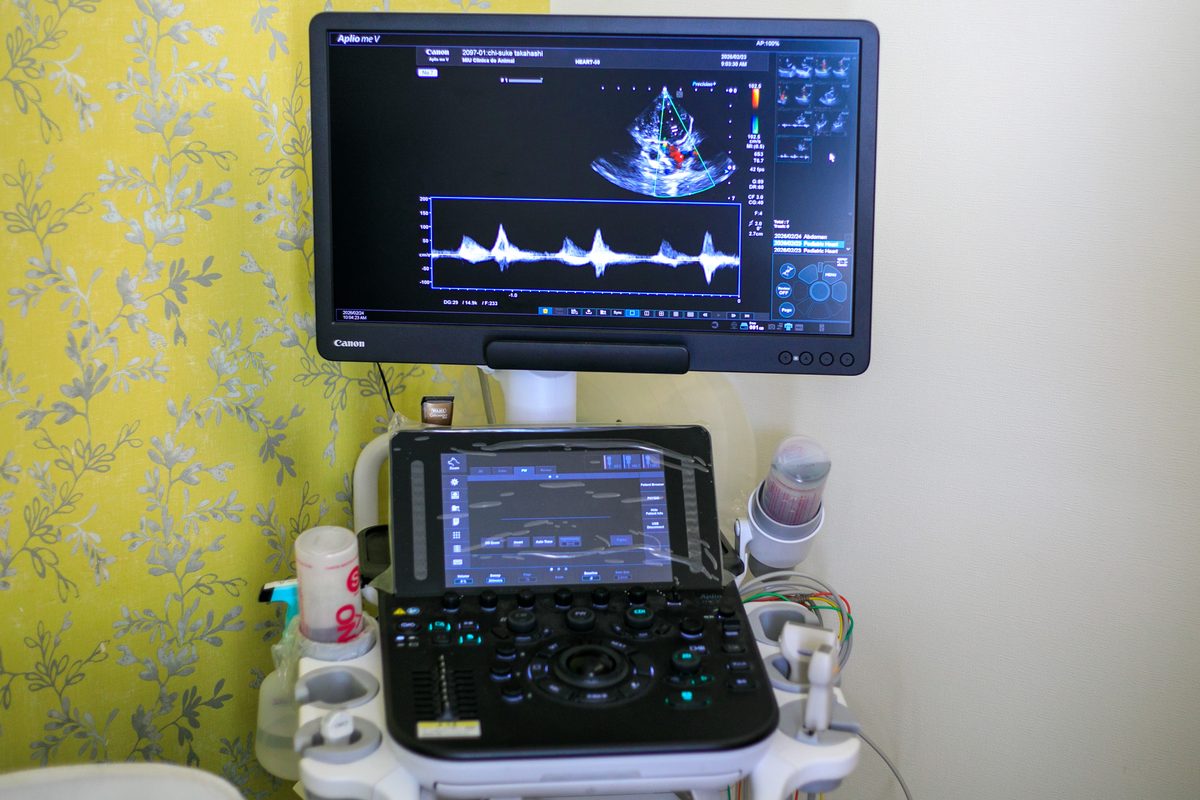 超音波検査機器